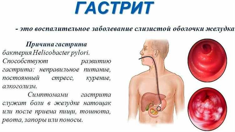 Питание для детей с гастритом и проблемами ЖКТ