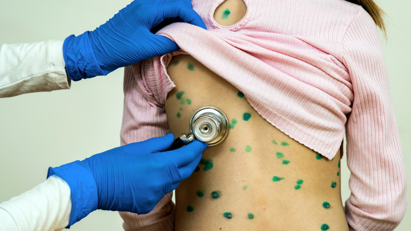 Ветряная буря в Алматы: дети под ударом инфекционного шторма