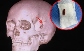 В Павлодаре медики извлекли 2-сантиметровую ветку из головы мальчика