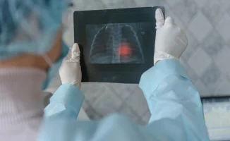 Туберкулёз выявлен у студентов вузов Казахстана: Минздрав подтверждает серьезность ситуации